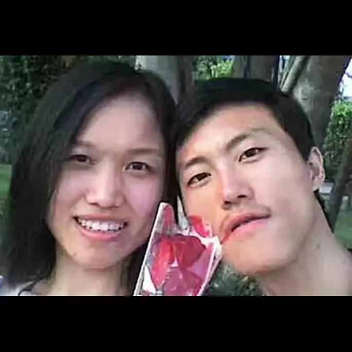 Berantem hebat, cowok ini potong lengan pasangannya yang sedang hamil