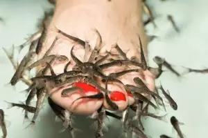 Gara-gara spa ikan, nasib kaki wanita ini berakhir tragis