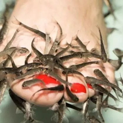 Gara-gara spa ikan, nasib kaki wanita ini berakhir tragis