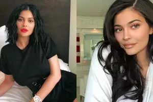 Lepas suntik filler di bibir, Kylie Jenner dipuji habis-habisan