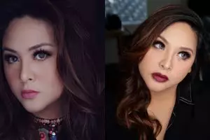 Sering dibully gara-gara fisiknya, begini respons bijak Audy Item