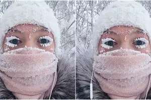 Ingat cewek yang bulu matanya beku? Foto terbarunya ini bikin bergidik