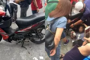 Dijambret, rambut wanita ini tersangkut rantai hingga nyaris putus