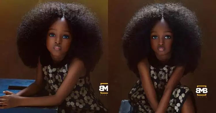 5 Potret Jare, bocah kulit hitam yang dijuluki gadis tercantik sedunia