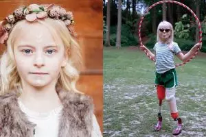 10 Potret Daisy-May Demetre, model cilik yang kedua kakinya diamputasi