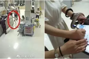 Digigit ular di semak-semak, reaksi wanita ini malah tak terduga