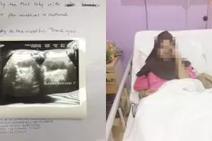 Pengen kulit putih dan cantik, kondisi wanita ini endingnya miris