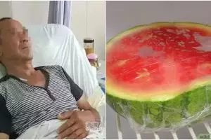 Cuma gara-gara makan semangka, 70 cm usus pria ini malah membusuk