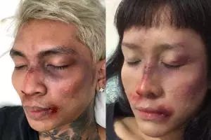 10 Foto editan Young Lex babak belur ala warganet, bikin senyum kecut