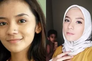 Jadi ciri khas, 4 seleb ini malah nekat hilangkan tahi lalat di wajah