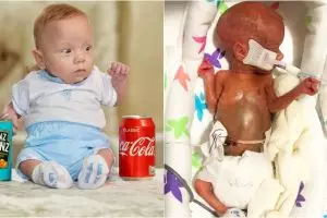 Kisah Theo Taylor, bayi seukuran kaleng soda yang bertahan hidup