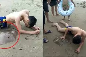 Lagi berenang di laut, pria ini alami hal mengerikan yang bikin ngilu