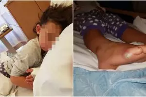 Gara-gara nyobain sepatu baru, kondisi anak ini berakhir miris