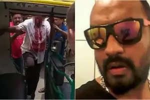 Pria ini tega cungkil mata ayahnya gara-gara warisan, anak durhaka