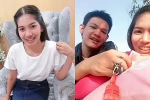 10 Potret Atittaya, cewek setia dampingi kekasih sakit kanker mata