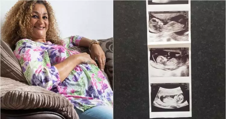 Kisah wanita usia 50 tahun yang hamil bayi kembar 4 ini bikin salut