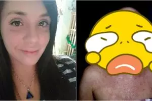 Gara-gara salah pakai krim kulit, nasib wanita ini berakhir tragis