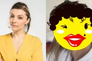 Bukannya senang akan nikah, wanita ini stres & kondisinya menyedihkan