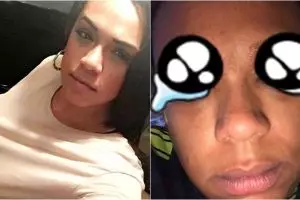 Salah prosedur tato alis, yang terjadi pada wanita ini mengenaskan