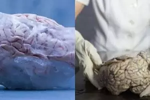 Alasan suami istri bekukan otaknya usai meninggal ini nyeleneh banget