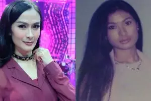 8 Potret lawas Iis Dahlia, bukti perubahannya bikin pangling