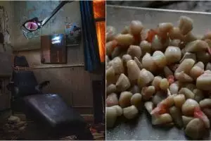 10 Foto seram klinik gigi terbengkalai, ada ratusan gigi copot