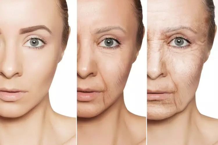 Cara canggih mengencangkan kulit wajah tanpa operasi plastik