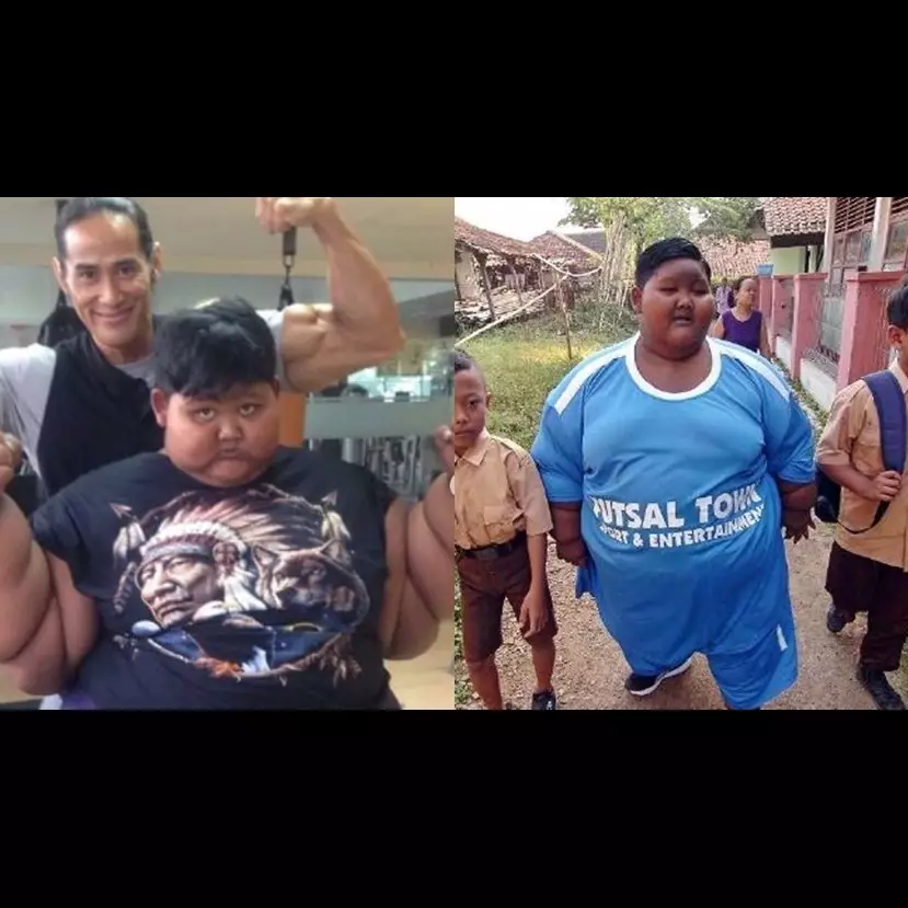 7 Perubahan Aria Permana bocah obesitas 192 kg, bikin pangling