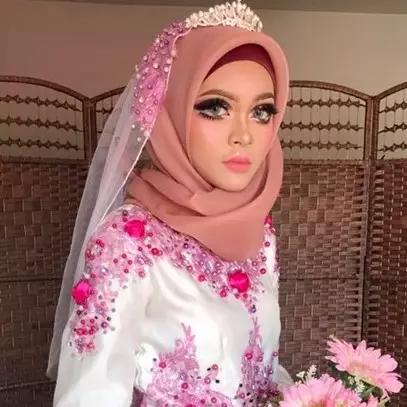 Pakai softlens saat acara pernikahan, nasib pengantin ini tragis