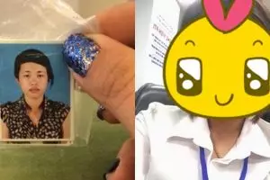 Lakukan operasi plastik, transformasi cewek ini bikin melongo