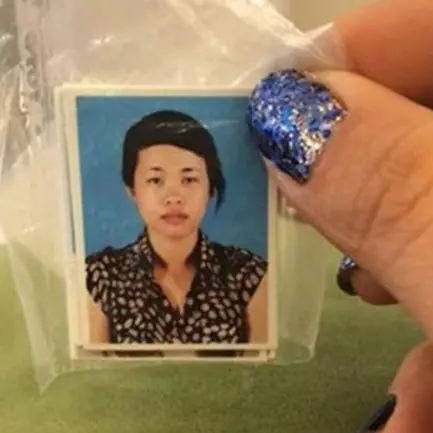 Lakukan operasi plastik, transformasi cewek ini bikin melongo