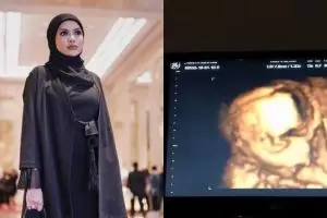 Curahan hati Nikita Mirzani berjuang hamil tanpa suami, bikin haru