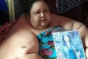 4 Fakta penyebab obesitas Titi Wati, wanita berbobot 350 kg