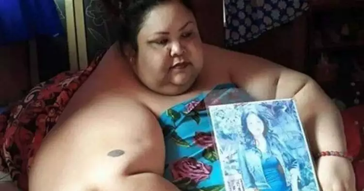 4 Fakta penyebab obesitas Titi Wati, wanita berbobot 350 kg