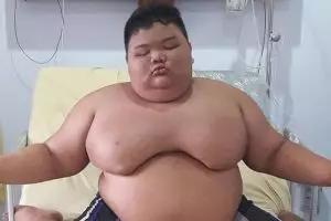 4 Kisah orang obesitas ini viral di Indonesia, terbaru Titi Wati