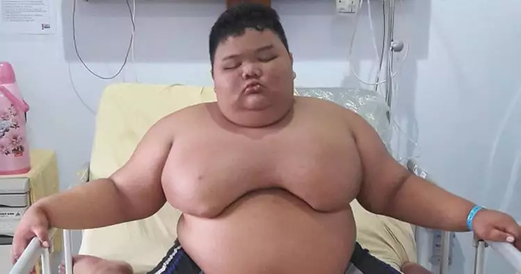 4 Kisah orang obesitas ini viral di Indonesia, terbaru Titi Wati