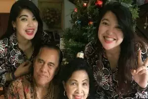 Usai 32 tahun, begini kabar terbaru kembar dempet Yuliana-Yuliani