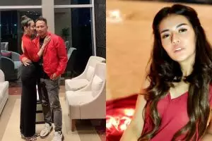 10 Potret Anggia Chan, model yang dikabarkan dekat Vicky Prasetyo