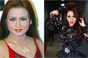 8 Foto seleb Tanah Air sebelum dan sesudah operasi plastik