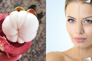 10 Manfaat buah manggis untuk kesehatan, mencegah alzheimer