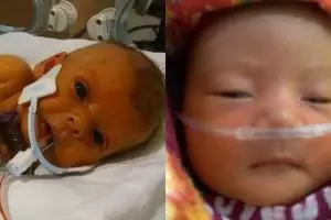 Kisah pilu orangtua minta edit foto anaknya tanpa selang medis