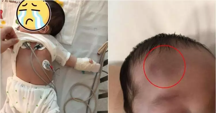 Kisah pilu bayi 2 bulan jatuh dari tangga, tempurung kepalanya retak
