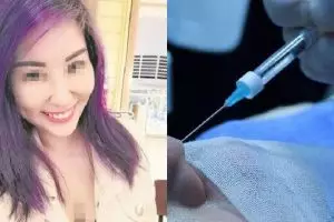 Gara-gara perawatan Botox, nasib wanita cantik ini berujung tragis