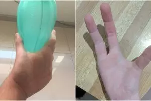 15 Orang ini alami kelainan genetik tapi malah terlihat unik