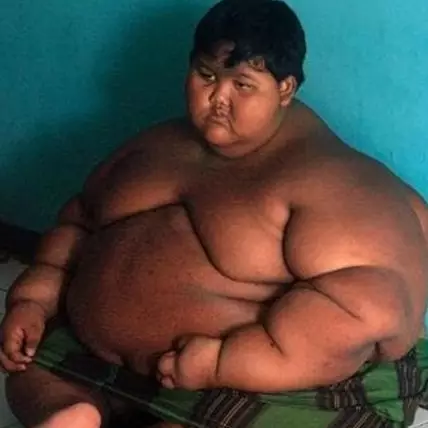 8 Potret terbaru Arya Permana yang dulu beratnya nyaris 200 kg