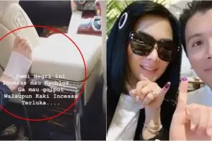 Syahrini datang ke TPS dengan kaki pincang, ini penyebabnya