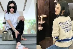 Begini penampakan kaki bengkak Syahrini usai perban dibuka