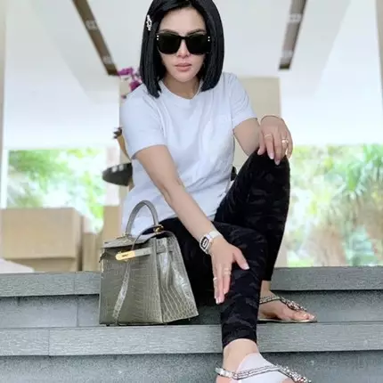 Begini penampakan kaki bengkak Syahrini usai perban dibuka