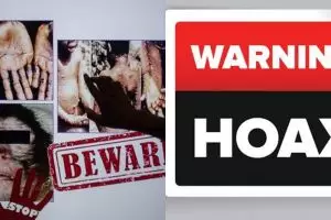 3 Fakta kabar hoax terkait cacar monyet, tetap waspada