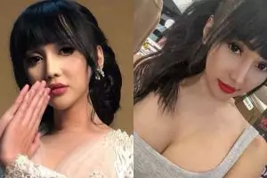 7 Perawatan kecantikan Lucinta Luna, ini rincian biayanya